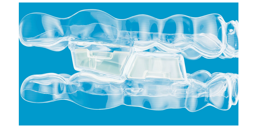 Align Know-how Launches Invisalign® System with Mandibular Growth for Class II Correction