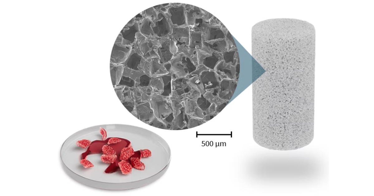 Revolutionary Bone Regeneration Technology Successfully Implemented in First Patient Surgery