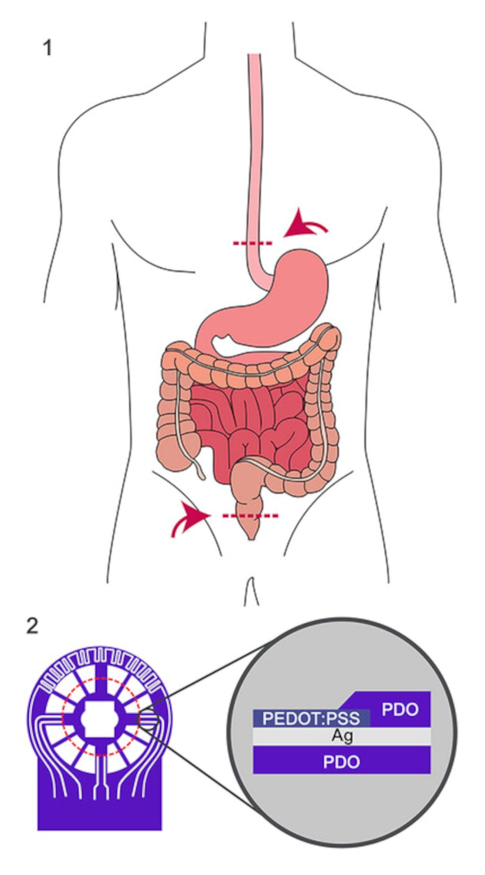 Revolutionary Sensor Know-how Enhances Early Detection of Issues Put up-Intestinal Surgical procedure